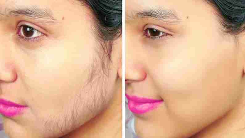 Unwanted Hair: ముఖంపై అవాంఛిత రోమాలతో ఇబ్బందులు పడుతున్నారా.. ఈ సింపుల్ చిట్కాలు ట్రై చేస్తే సరి