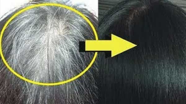 White Hair Prevention: తెల్ల జుట్టు చికాకుగా మారిందా..? ఈ చిట్కాలతో చెక్ పెట్టేయండి