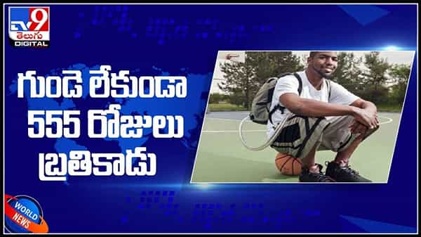 గుండె లేకుండా 555 రోజులు బ్రతికాడు..బ్యాగ్ లో గుండెను మోస్తూ జీవనం.అస్సలు సాధ్యం అవుతున్న ..?:american lived without heart video.