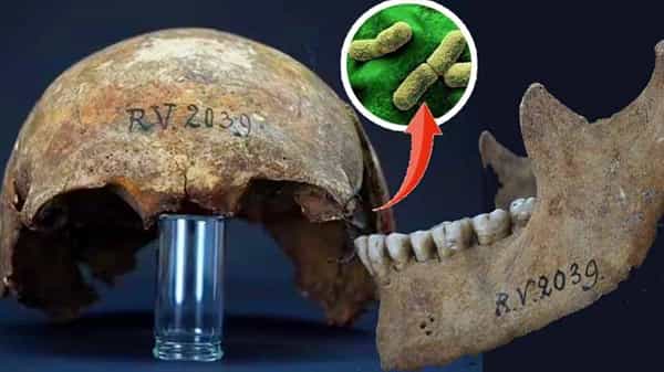 Black Death: ఐదువేల ఏళ్ళనాటి పుర్రె చెప్పిన నిజం.. బ్లాక్ డెత్ కలుగచేసే బాక్టీరియా అప్పటినుంచే ఉంది!