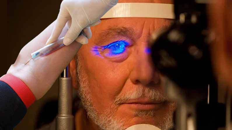 Glaucoma tests: గ్లకోమా కంటి వ్యాధిని జన్యు పరీక్షలతో గుర్తించే సులువైన మార్గం కనిపెట్టిన పరిశోధకులు..ఇది ఎలా అంటే..