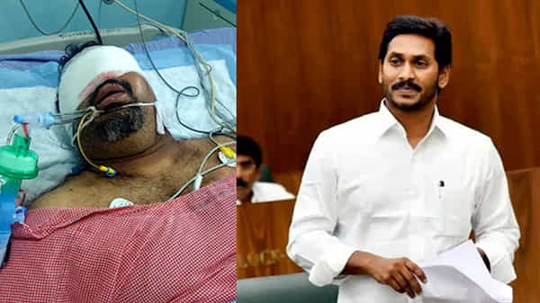 Kathi Mahesh: కత్తి మహేష్కు చికిత్స నిమిత్తం సీఎం జగన్ భారీ ఆర్థిక సాయం.. అతడి ఆరోగ్య పరిస్థితి ఎలా ఉందంటే