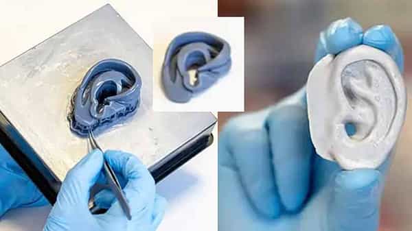 New Invention: ప్రమాదంలో చెవి..ముక్కు దెబ్బతిన్నాయా? మీకో గుడ్న్యూస్! త్రీడీ ప్రింట్తో ఒరిజినల్ రెడీ చేసేస్తారు..