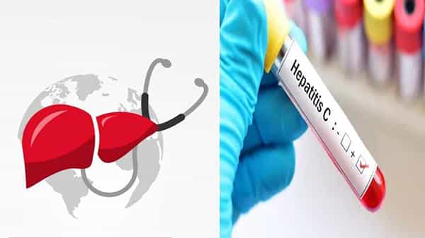 World Hepatitis Day: చివరి వరకూ బయటపడకుండా ప్రాణాన్ని హరించే హెపటైటిస్.. ఈ వ్యాధిని గుర్తించడం ఎలా ..