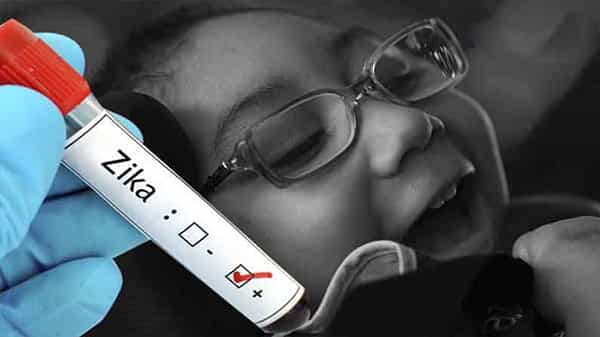 Zika virus Cases: కేరళలో జికా వైరస్ కలకలం.. తిరువనంతపురంలో 15 కేసులు గుర్తింపు.. బాధితుల ట్రావెల్ హిస్టరీపై ఆరా