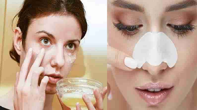 Tips For Black Heads: ముక్కుపై బ్లాక్స్‌హెడ్స్ ఇబ్బంది పెడుతున్నాయా.. ఈ వంటింటి చిట్కాలు అప్లై చేసి చూడండి