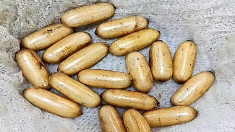 Cocaine Smuggling: అచ్చం సూర్య సినిమాలానే.. పొట్టలో రూ.10 కోట్ల డ్రగ్స్.. థ్రిల్లింగ్ క్రైం స్టోరీ