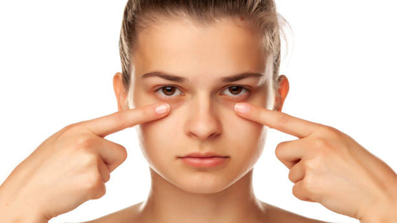 Swollen Eyes Tips: నిద్రలేమి కారణంగా మీరూ ఈ సమస్య ఎదుర్కొంటున్నారా? అయితే ఈ చిట్కాలు ఫాలో అవ్వండి.