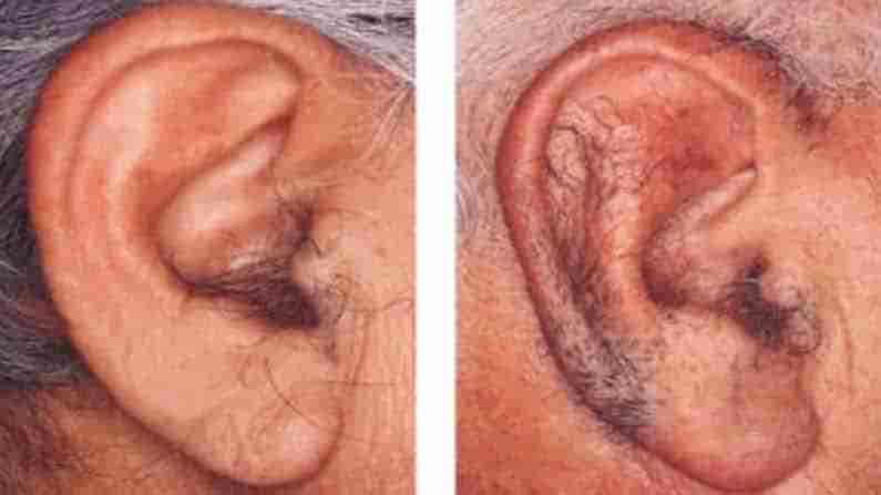 Hairy Ears: పురుషుల చెవిపై వచ్చే వెంట్రుకలు వల్ల ఏదైనా ప్రమాదాలు ఏర్పడతాయా..