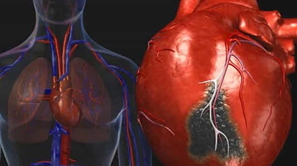 Heart Problems: కరోనా చికిత్సలో వాడే ఆ మందు గుండె జబ్బులలోనూ వాడొచ్చు.. తాజా పరిశోధనల్లో వెల్లడి!