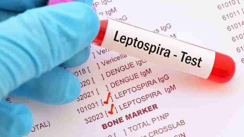 Leptospirosis: వర్షాకాలంలో విజృంభించే బ్యాక్తీరియల్ ఇన్ఫెక్షన్ లెప్టోస్పిరోసిస్.. ఎలా వస్తుంది..ప్రమాదం ఏమిటి తెలుసుకోండి!