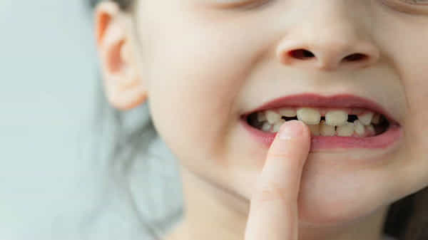 Milk Teeth: పిల్లలు తమ పాల దంతాలను ఎందుకు కోల్పోతారు.. దీని వెనుక అసలైన కారణం ఇదే..!