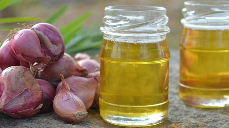 Onion Oil: జుట్టు రాలడం, తెల్లబడడం, చుండ్రు సమస్యలకు ఒకటే పరిష్కారం.. ఈ నూనె అప్లై చేసి అద్భుతం ఫలితం పొందండి