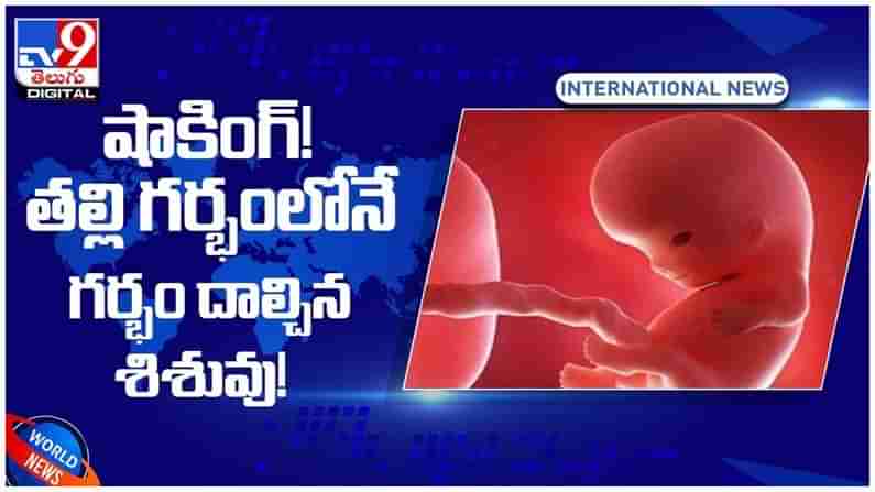 Shocking Video: షాకింగ్‌..!! తల్లి గర్భంలోనే గర్భం దాల్చిన శిశువు.. వీడియో