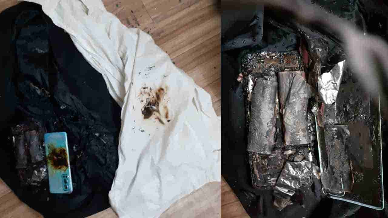 OnePlus Nord 2 Explodes: లాయర్ కోటు జేబులో మంటలు, పొగలు.. ఏంటా అని చూస్తే ఊహించని పేలుడు.. పూర్తి వివరాలు మీకోసం..