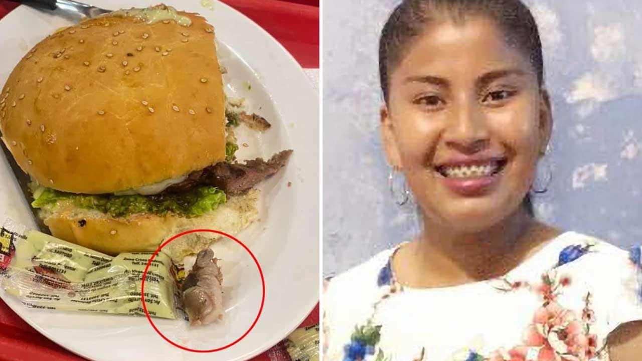 Human Finger in Burger: బర్గర్‌లో బయట పడిన మనిషి వేలు.. బర్గర్ తింటున్న యువతికి షాక్.. సోషల్ మీడియాలో వైరల్