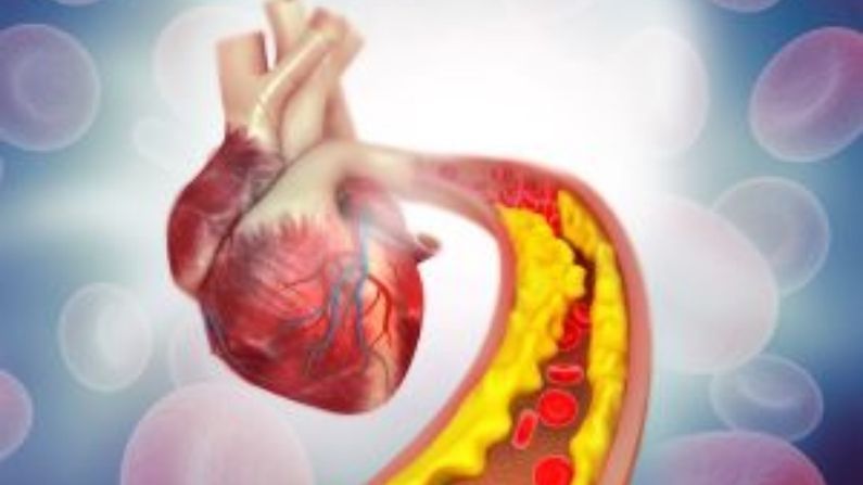 Cholesterol Drug: చెడు కొలెస్ట్రాల్కు చెక్.. ఇంజెక్షన్ రూపంలో సరికొత్త ఔషధం.. ఖరీదు తెలిస్తే షాకవ్వాల్సిందే?