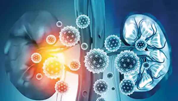 Kidney Problems: కరోనాతో ఐసీయూలో చేరిన వారిలో కిడ్నీ సమస్యలు.. మూత్రపిండాల ఆరోగ్యం జాగ్రత్తగా చూసుకోవడం ఎలా?
