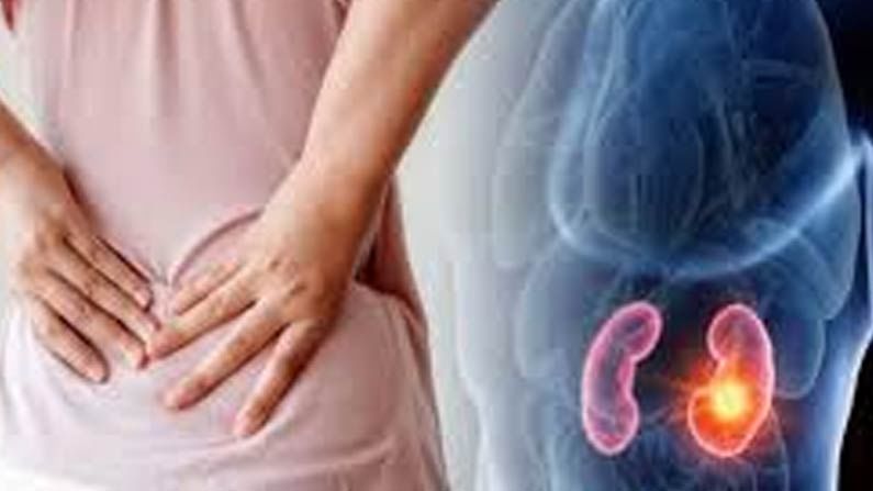 Kidney Stones: కిడ్నీలలో రాళ్లు ఉన్నవారు ఈ 4 ఆహార పదార్థాలను అస్సలు తినకూడదు..! ఎందుకంటే