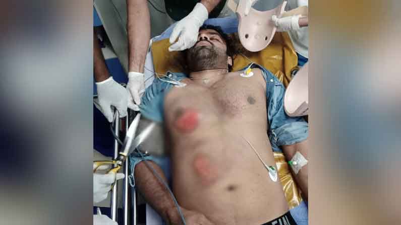 Sai Dharam Tej Accident: స్పృహలోకి వచ్చిన సాయి ధరమ్ తేజ్.. క్షేమంగా బయటపడటానికి కారణమదే..