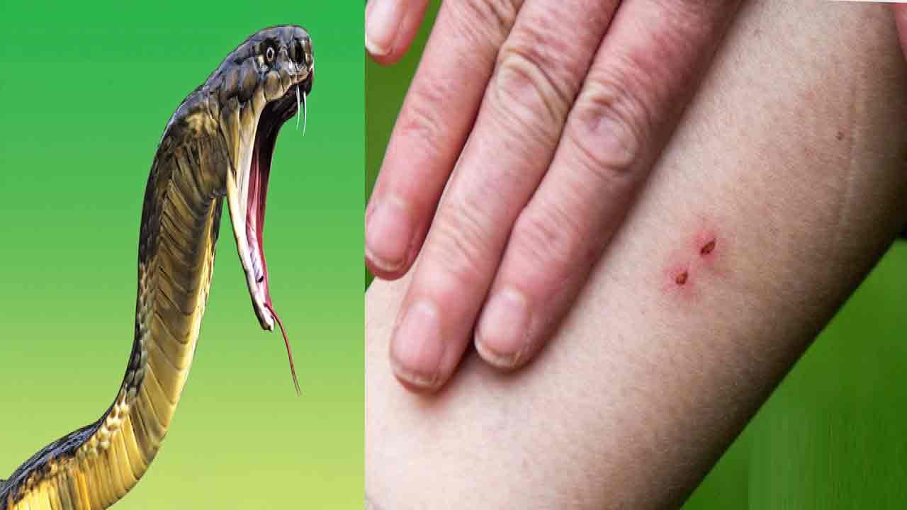 Snakebite:ఎంతటి విషపు పాము కరిచినా….ఇలా చేస్తే ప్రాణాలు రక్షించవచ్చు.. ప్రతి ఇంట్లో ఉండాల్సిన హోమియోపతి మందు ఏమిటో తెలుసా