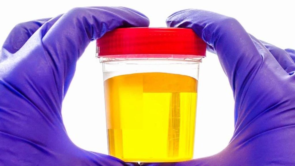 Urine Colour: మూత్రం రంగులో మార్పులు కనిపిస్తున్నాయా.? అయితే మీరు వ్యాధుల బారిన పడుతున్నట్లే. అవేంటో తెలుసుకోండి.. Urine Colour: మూత్రం రంగులో మార్పులు కనిపిస్తున్నాయా.? అయితే మీరు వ్యాధుల బారిన పడుతున్నట్లే. అవేంటో తెలుసుకోండి..