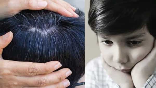 Health Tips: చిన్న పిల్లల జుట్టు ఎందుకు తెల్లబడుతుంది..! నియంత్రించాలంటే ఏం చేయాలి..?
