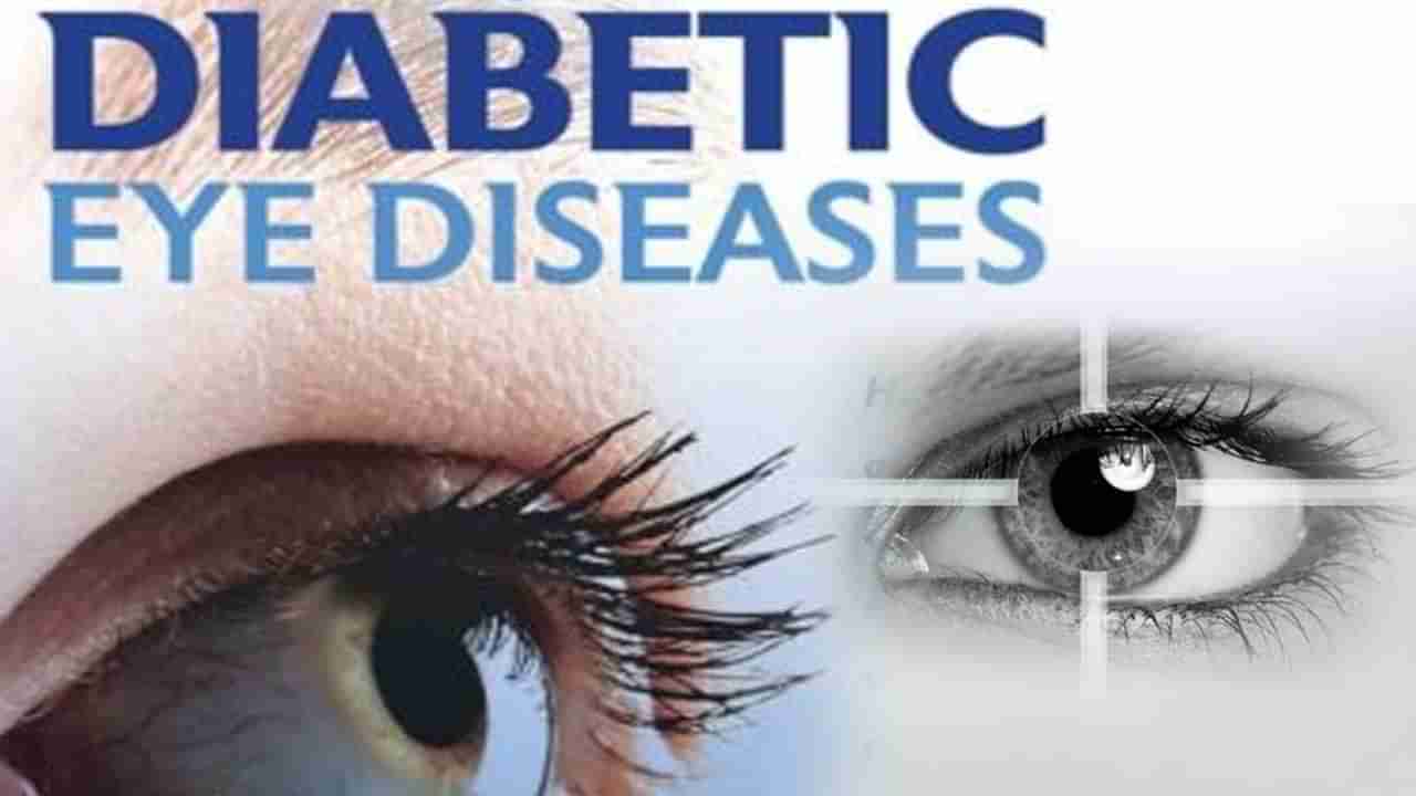 Diabetes: మధుమేహం ఉన్నవారికి కళ్ళ వ్యాధులు వచ్చే అవకాశం ఎక్కువ.. ఇబ్బందులు నివారించడానికి ఏమి చేయాలంటే..