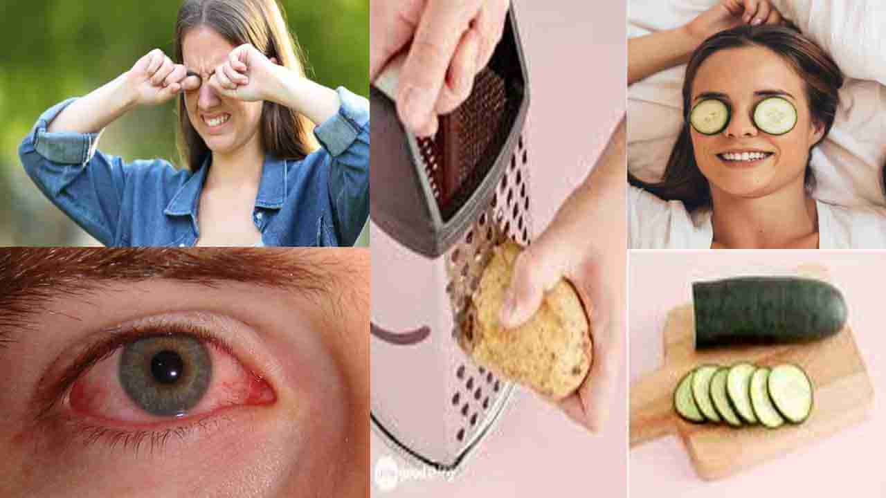 Eye Care Tips: కళ్ళకు విశ్రాంతి లేదా.. ఎర్రగా మారి దురదలు పెడుతున్నాయా.. ఈ చిట్కాలతో ఉపశమనం పొందండి