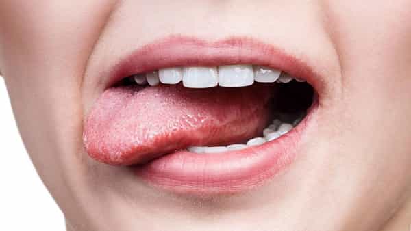 Health: నోట్లో ఇలాంటి లక్షణాలు కనిపిస్తాయా? ఎందుకైనా మంచిది టెస్ట్ చేయించుకోండి.. డయాబెటిస్ అయ్యుండొచ్చు.