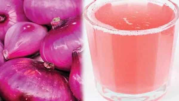 Onion Juice: ఉల్లిపాయ రసంతో రాళ్ల సమస్యకు చెక్..! ఇంకా అనేక ఆరోగ్య ప్రయోజనాలు