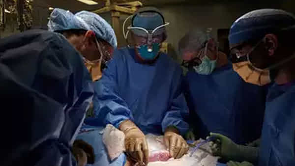 Pig Kidney Transplant: న్యూయార్క్ వైద్యుల అరుదైన ఘనత.. పంది మూత్రపిండాన్ని మనిషికి మార్పిడి..