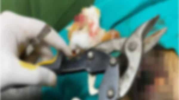 Shocking News: బాటిల్లో ఇరుక్కుపోయిన ప్రైవేట్ పార్ట్.. 2 నెలల తరువాత డాక్టర్కి చూపిస్తే కట్ చేసి పారేశారు..!