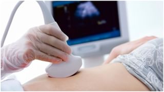 Banana Benefits: రోజూ అరటిపండు తింటే ఆ వ్యాధులను తగ్గించవచ్చు…. ప్రయోజనాలు తెలుసుకోండి.. 