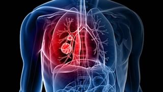 Guava Health Benefits: జామ, ఆకులతో ఇన్ని ఉపయోగాలా..? తెలిస్తే ఆశ్చర్యపోతారు.. పూర్తి వివరాలు..!