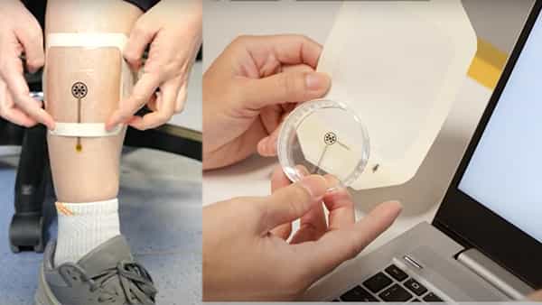 Smart Bandage: ఈ స్మార్ట్ బ్యాండేజ్ శరీరంలో గాయాల పరిస్థితిని ఎప్పటికప్పుడు మీకు చెబుతుంది.. ఎలా అంటే..
