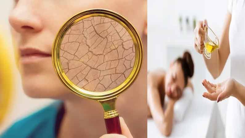 Winter Skincare Tips: శీతాకాలంలో పొడి చర్మం ఉన్నవారు చేయాల్సిన, చేయకూడని పనుల ఏమిటంటే..