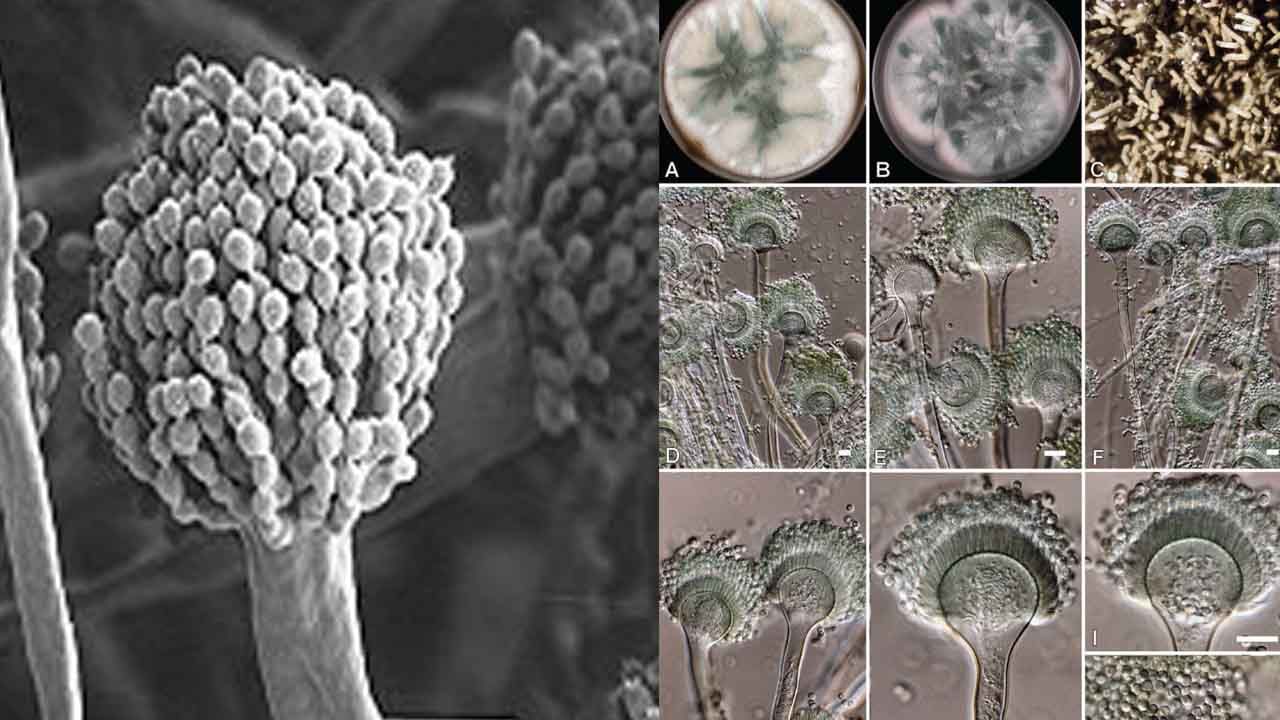 Fungal Infection: ఢిల్లీ ఎయిమ్స్ లో కలవరపెడుతున్న కొత్త ఫంగస్ వ్యాధి.. ఇద్దరి మరణంతో వైద్యుల అలెర్ట్!
