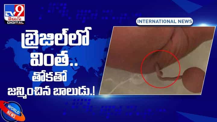 Viral Video: బ్రెజిల్లో వింత !! తోకతో జన్మించిన బాలుడు !! వీడియో Viral Video: బ్రెజిల్లో వింత !! తోకతో జన్మించిన బాలుడు !! వీడియో