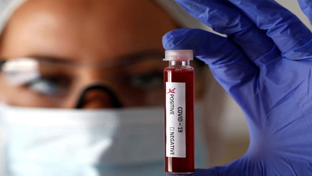 Coronavirus: మహారాష్ట్రాలో ఒమిక్రాన్ కలకలం..? సౌతాఫ్రిక నుంచి వచ్చిన ప్రయాణికుడికి కరోనా పాజిటివ్.. Coronavirus: మహారాష్ట్రాలో ఒమిక్రాన్ కలకలం..? సౌతాఫ్రిక నుంచి వచ్చిన ప్రయాణికుడికి కరోనా పాజిటివ్..