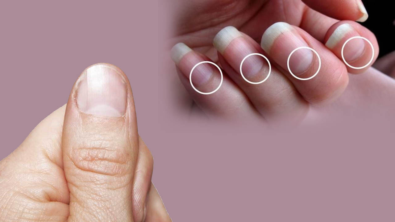 Fingernails: మీ చేతిగోళ్లలో దీనిని చూసి ఆనారోగ్య సమస్యలను గుర్తించవచ్చు.. ఏ రంగు మారితే ఎలాంటి వ్యాధులు వస్తాయి!