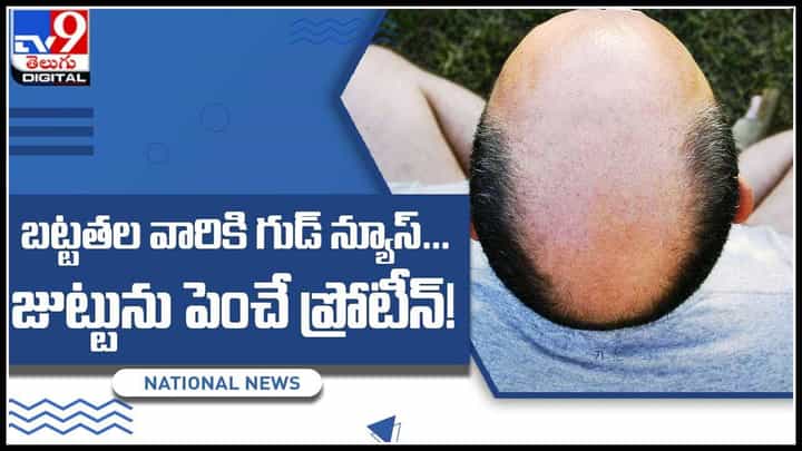 Bald Head: బట్టతల బాబాయ్లకు గుడ్ న్యూస్... జుట్టును పెంచే ప్రోటీన్ ను గుర్తించిన పరిశోధకులు.. (వీడియో) Bald Head: బట్టతల బాబాయ్లకు గుడ్ న్యూస్... జుట్టును పెంచే ప్రోటీన్ ను గుర్తించిన పరిశోధకులు.. (వీడియో)