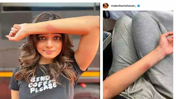 Malavika Mohanan: షూటింగ్లో గాయపడిన మాస్టర్ హీరోయిన్.. ఫొటోలు వైరల్..