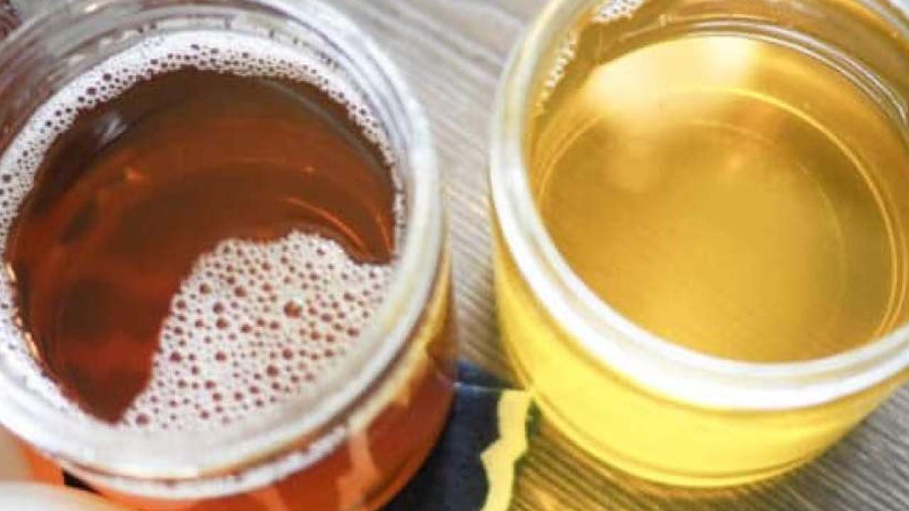 Ghee and Oil: బరువు పెరుగుతున్నామని నెయ్యి.. నూనెలను దూరం పెట్టేస్తున్నారా? అయితే, మీకు అనారోగ్యం ఖాయం ఎలా అంటే..