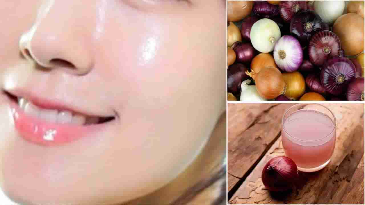 Onion Face Pack: ఉల్లిపాయ ఫేస్‌ప్యాక్.. ఇలా చేస్తే తళుక్కుమనే అందం మీ సొంతం..