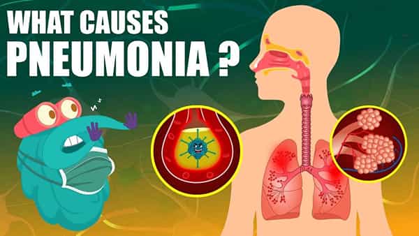 Pneumonia: చలి పెరుగుతోంది.. ఊపిరితిత్తుల వ్యాధి న్యుమోనియాతో జాగ్రత్తగా ఉండాలి.. దీని గురించి పూర్తిగా తెలుసుకోండి!