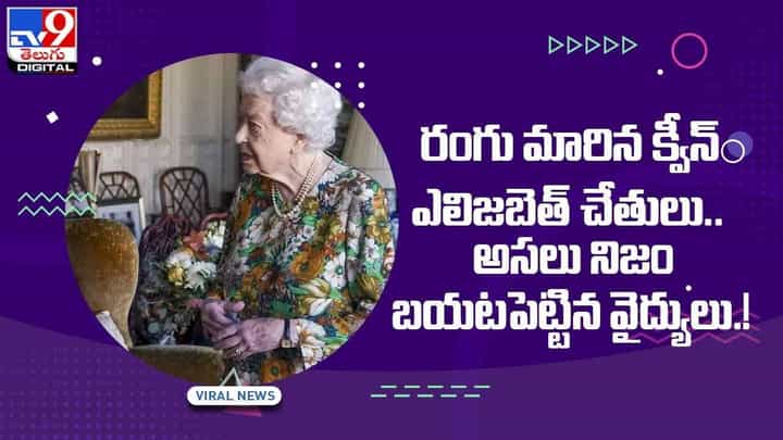 రంగు మారిన క్వీన్ ఎలిజబెత్ చేతులు !! అసలు నిజం బయటపెట్టిన వైద్యులు !! వీడియో రంగు మారిన క్వీన్ ఎలిజబెత్ చేతులు !! అసలు నిజం బయటపెట్టిన వైద్యులు !! వీడియో