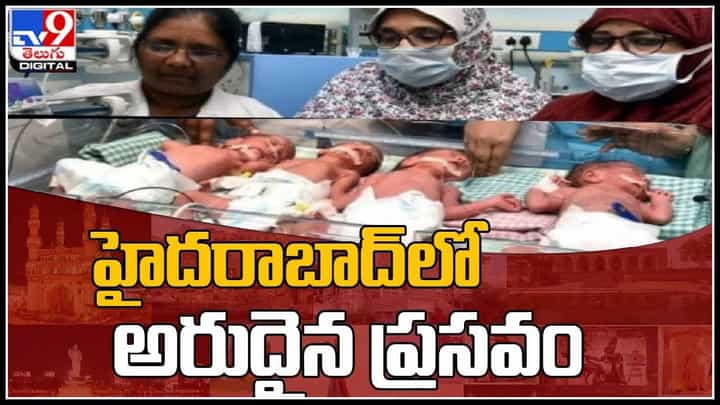 Woman Delivers 4 babies: హైదరాబాద్లో అరుదైన ప్రసవం.. ఓ గర్భిణికి అత్యంత అరుదుగా నలుగురు బిడ్డలు.. (వీడియో) Woman Delivers 4 babies: హైదరాబాద్లో అరుదైన ప్రసవం.. ఓ గర్భిణికి అత్యంత అరుదుగా నలుగురు బిడ్డలు.. (వీడియో)