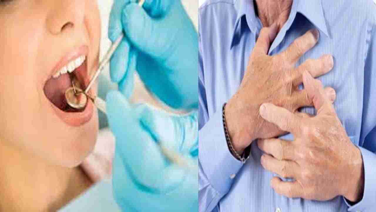 Tooth Infection: నోరు శుభ్రంగా ఉంటే మీ గుండె పదిలం.. నోరు అపరిశుభ్రంగా ఉంటే.. కలిగే వ్యాధులు ఎన్నో తెలుసా..