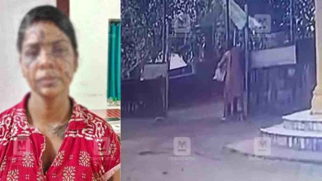 Crime News: ప్రేమ గుడ్డి వాడిని చేసింది.. పెళ్లి తిరస్కరించిన యువకుడిపై యాసిడ్ పోసిన వివాహిత! Crime News: ప్రేమ గుడ్డి వాడిని చేసింది.. పెళ్లి తిరస్కరించిన యువకుడిపై యాసిడ్ పోసిన వివాహిత!